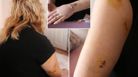 Diyarbakır'da Dini Nikahlı Eşine Bıçaklı Saldırı Gerçekleşti