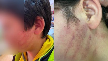 Karatay'da Okulda Veli Saldırısı: İki Çocuk Darp Edildi