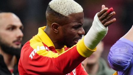 Osimhen'in koruma ekipmanı derbi öncesi mercek altında