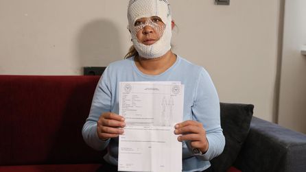 Prenses cilt bakımı bu hale getirdi: Oğlum \"öcü\" deyip benden kaçıyor