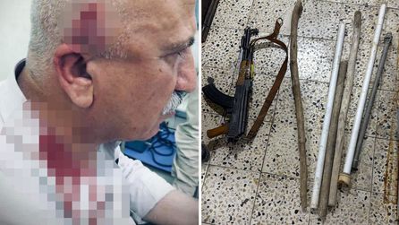 Kerkük'te Kaymakama Bıçaklı ve Sopalı Saldırı Gerçekleşti