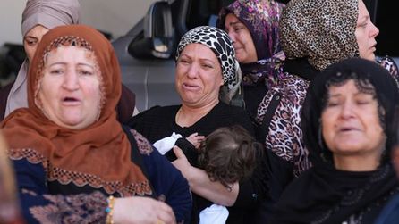 İzmir'de burun estetiği sonrası genç kadın hayatını kaybetti