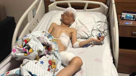 Van'daki köpek dehşetinde kan donduran detaylar