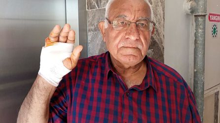Reyhanlı'da komşu kavgası: Bir kişi parmağından oldu