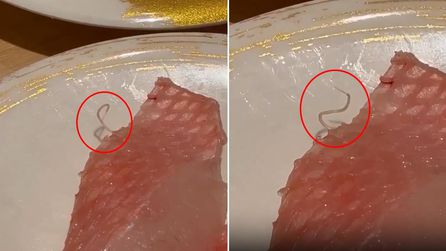 Hong Kong'daki Suşi Restoranında Canlı Parazit Skandalı Yaşandı