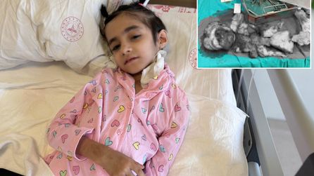 Eskişehir'de 8 yaşındaki Fatma'nın dev tümörü 6,5 saatlik operasyonla alındı