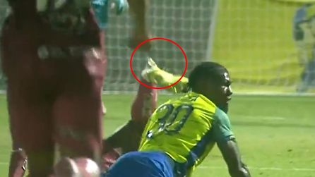 Romario'nun bacağı kırıldı, korku dolu anlar sahada yaşandı