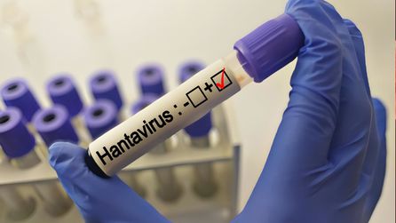 Hantavirüs belirtileri ve bulaşma yolları hakkında bilgiler