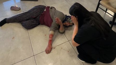 Köpek saldırısında kadın yaralandı, müdahale edenler durumu anlattı