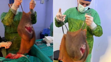 Aydın'da 40 Kilogramlık Kitle Ameliyatla Alındı
