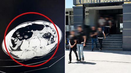 Batman'da uyuşturucu kuryeleri midesinden 2 kilo 726 gram uyuşturucu çıktı