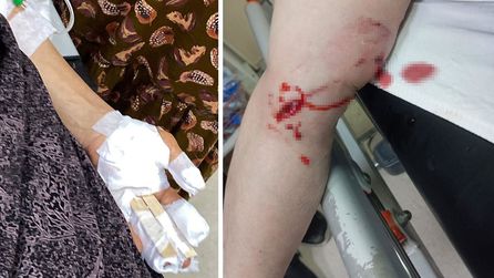 Silopi'de 3 kadın başıboş köpeklerin saldırısına uğradı