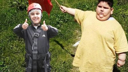 Yağız Bekte'nin kilo verme süreci ve tedavi süreci