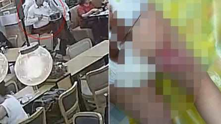 Baydöner restoranında kaynar yağ dökülen bebeğin durumu ağırlaştı
