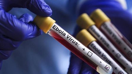 KKTC Sağlık Bakanlığı Ebola için yeni önlemler açıkladı