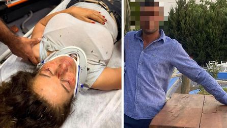 Sokak köpeği yardımına giden eczacı saldırıya uğradı