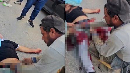 Antalya'da Akrabasını Vuran Sanık Mahkemede Özür Diledi