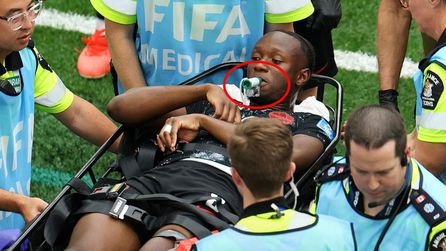 Ismael Kone'nin sakatlığı ve ağzındaki yeşil cihaz açıklandı