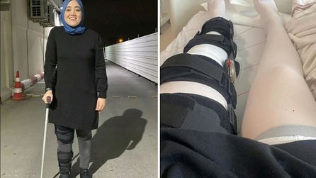 Yanlış diz ameliyatı sonrası tazminat davası açıldı
