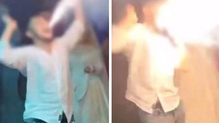 Düğün sırasında meşale patladı, genç yaralandı
