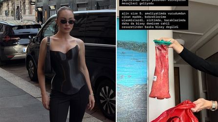 Danla Bilic yeniden ameliyat oldu, sağlık durumu hakkında bilgi verildi