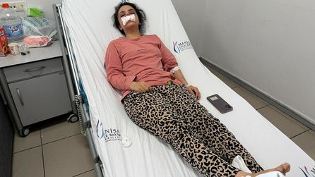Manisa'da Eşinin Burnunu Koparan Adam Tutuklandı