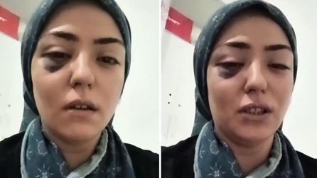 Gaziantep'te Şiddet Mağduru Anne Yardım Talep Etti
