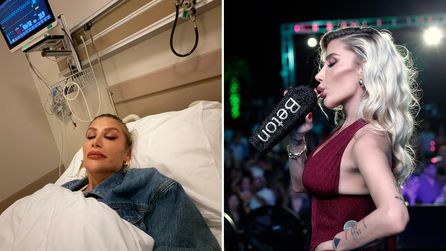 İrem Derici çene görüntüsüyle ilgili gerçekleri açıkladı