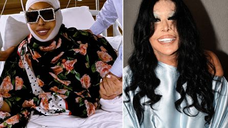 Bülent Ersoy estetik operasyonunu sahnede açıkladı