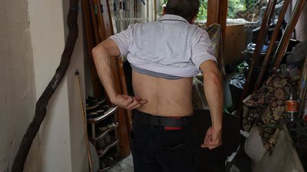 Adana'da doktor hatası sonrası işsiz kalan adamın dramı
